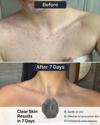 ELORAV™ SUD SCRUB